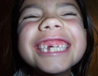 milkteeth.JPG